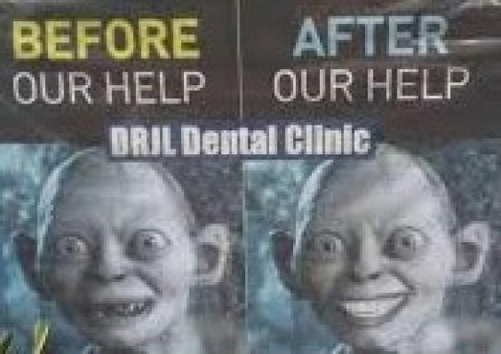 Publicité "avant" et "après" pour des soins dentaires.